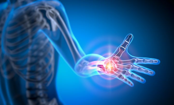 Grafik eines Arms mit sichtbaren Knochen, das Handgelenk leuchtet rot